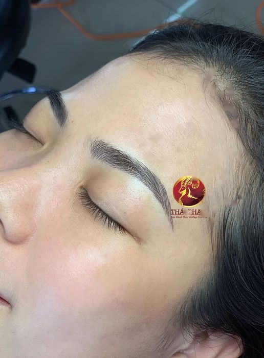 Hình ảnh sản phẩm tại thẩm mỹ Thái Phạm 1
