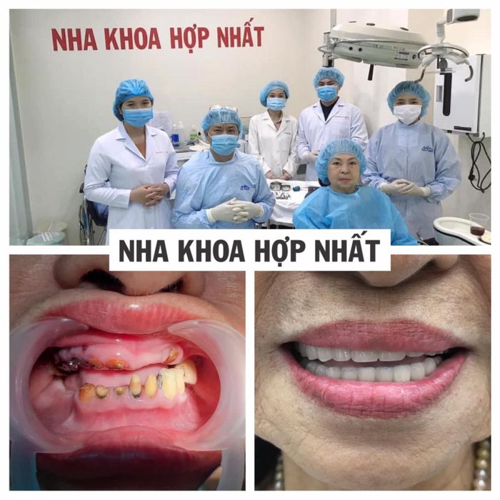 Nha Khoa Hợp Nhất hình ảnh 2