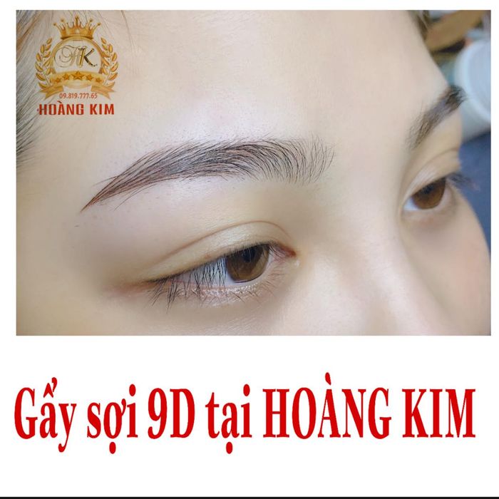 Thẩm Mỹ Hoàng Kim hình 2