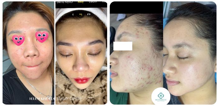 Hình ảnh Trung Tâm Helen Kim Cúc số 1