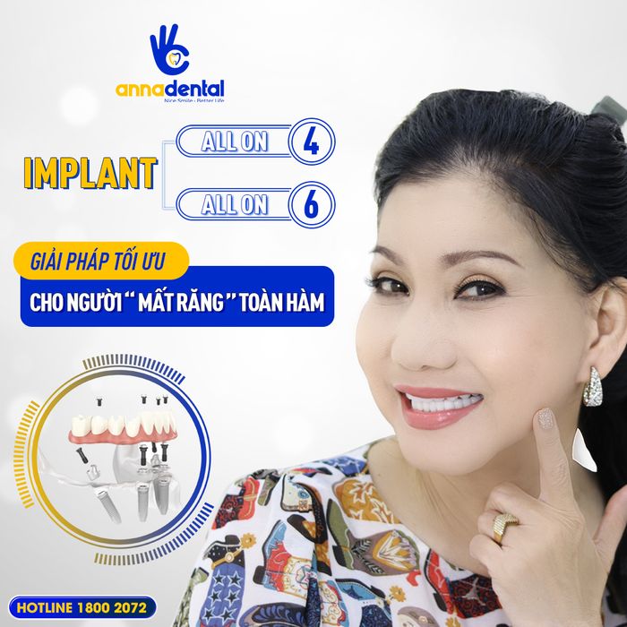 Hình ảnh 1 của Nha Khoa Anna - Trung Tâm Cấy Ghép Implant