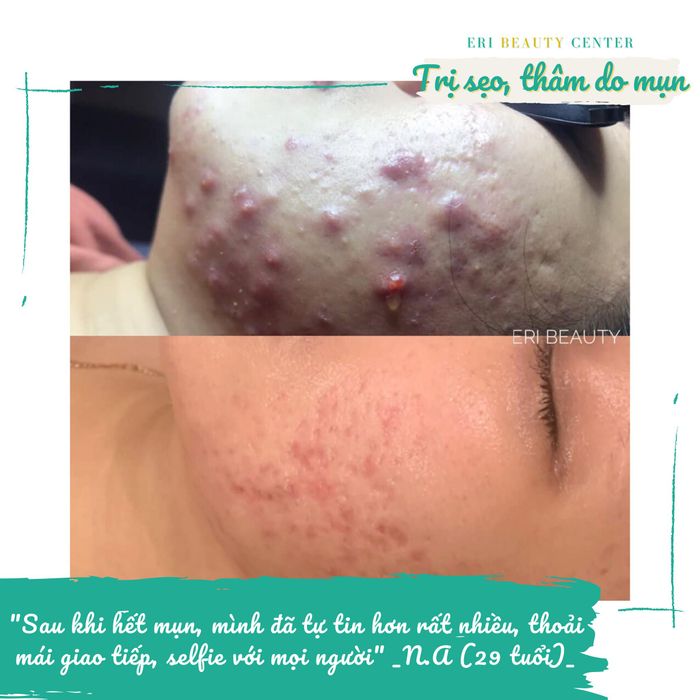 Hình ảnh ERI Beauty Center số 1