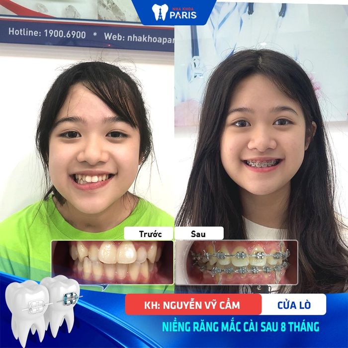 Nha Khoa Paris hình ảnh 2