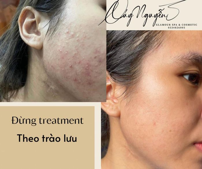 Hình ảnh 1 tại Glamour Spa