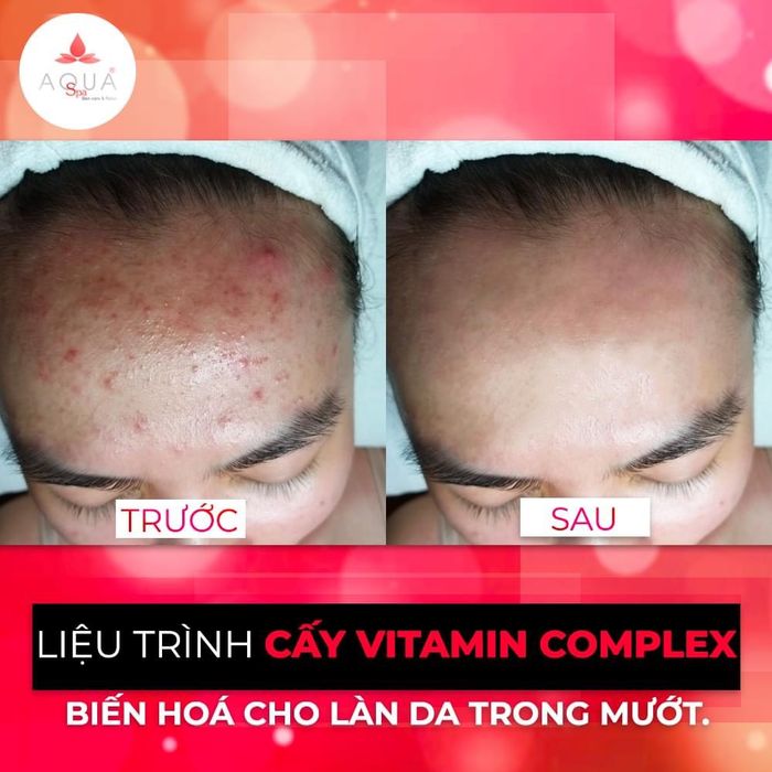 Ảnh của Aqua spa 1