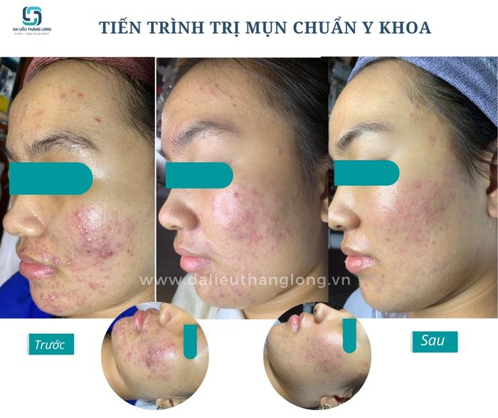 Thăng Long Beauty Clinic - Chi nhánh Ninh Bình hình ảnh 2
