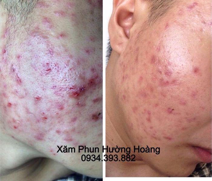 Ảnh 1 của Thẩm Mỹ Hường Hoàng