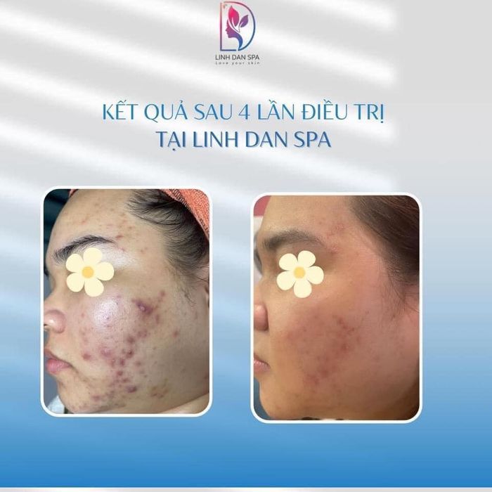 Hình ảnh 2 của Linh Đan Spa Clinic