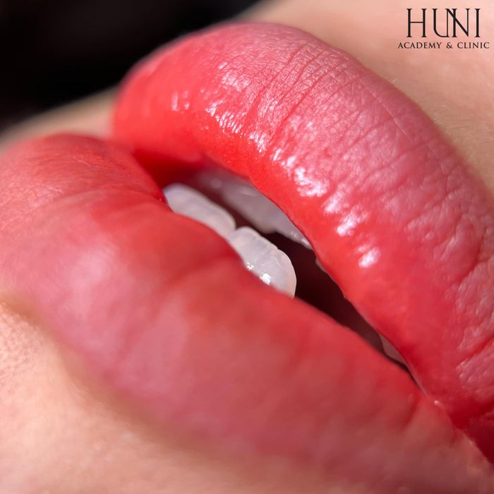 Huni Academy & Clinic - Hình ảnh 2