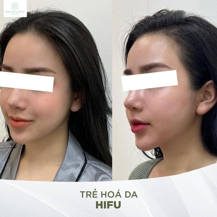 Ảnh 3 Trung tâm Spa HWASA