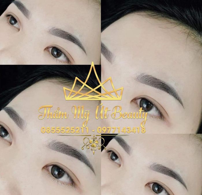 Thẩm mỹ Út Beauty - Hình ảnh 1