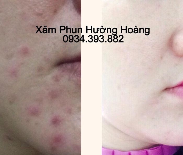 Thẩm Mỹ Hường Hoàng hình ảnh 2