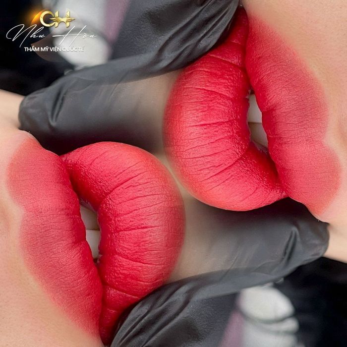 Hình ảnh 2 - Thẩm Mỹ Viện Quốc Tế Như Hoa