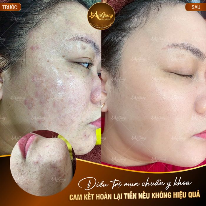 Hình ảnh 1 của An Giang Beauty & Spa