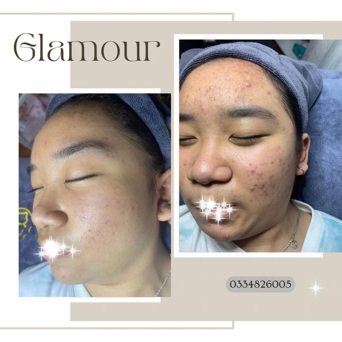 Hình ảnh 2 tại Glamour Spa