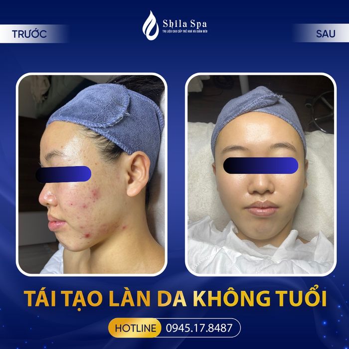 Hình ảnh 1 của Shila Spa & Massage