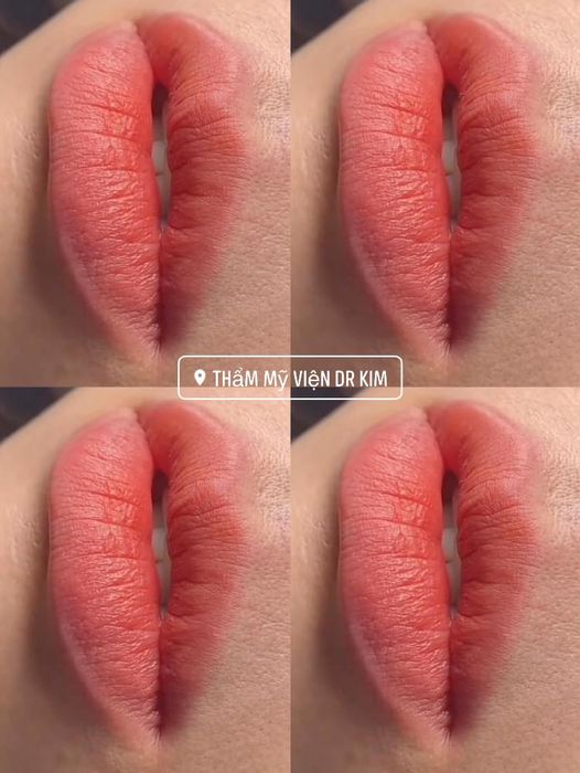 Hình ảnh Thẩm mỹ viện Dr Kim 3