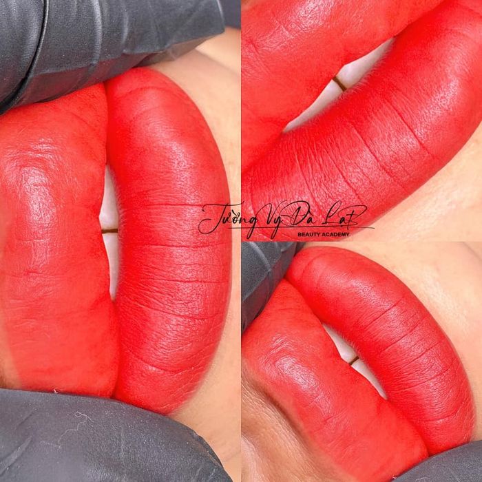 Hình ảnh 2 - Thẩm Mỹ Tường Vy Đà Lạt