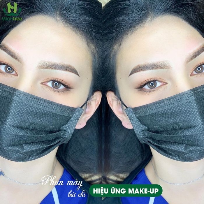 Hình ảnh 2 của Thẩm Mỹ Viện Wonhee Korea 2