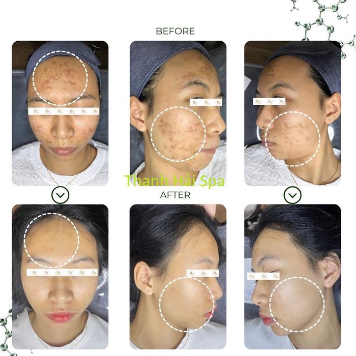 Hình ảnh 2 của Thanh Hải Spa