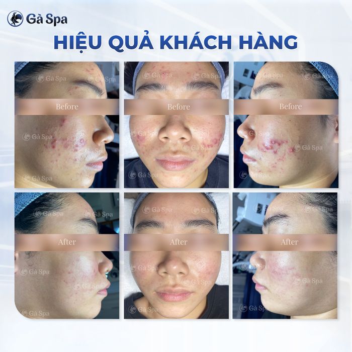 Gà Spa Biên Hòa - Hình ảnh 2