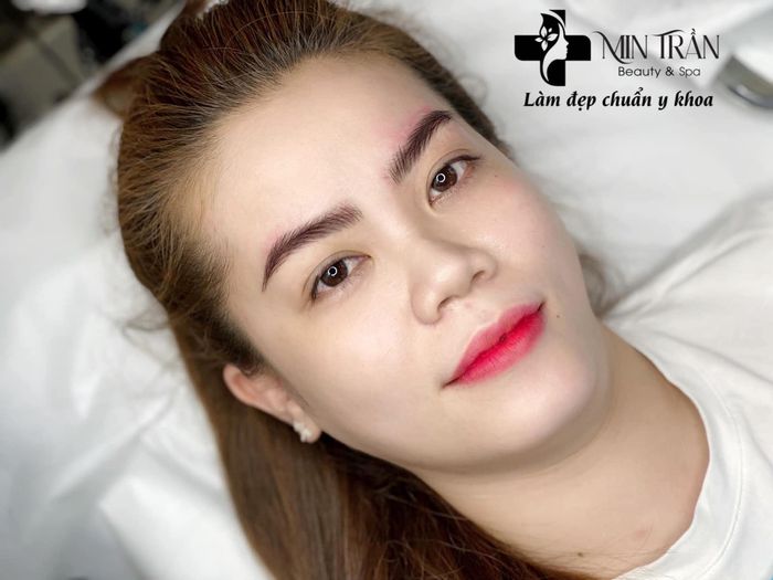 Min Trần Thẩm Mỹ - Hình ảnh 1