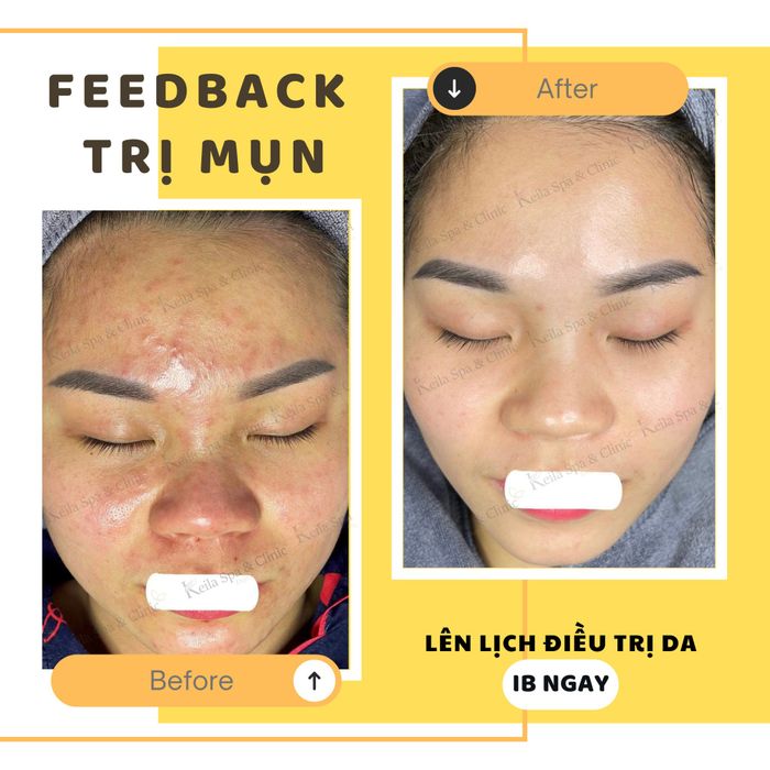 Hình ảnh 2 của Keila Spa & Clinic