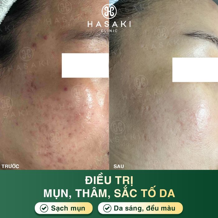 Ảnh 1 của Hasaki Clinic & Spa