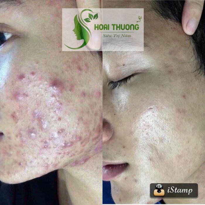 Hình ảnh 1 của Hoài Thương Spa