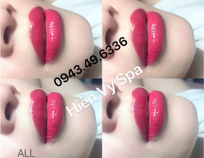 Hình ảnh 1 - Thẩm Mỹ Viện Hiền Vy