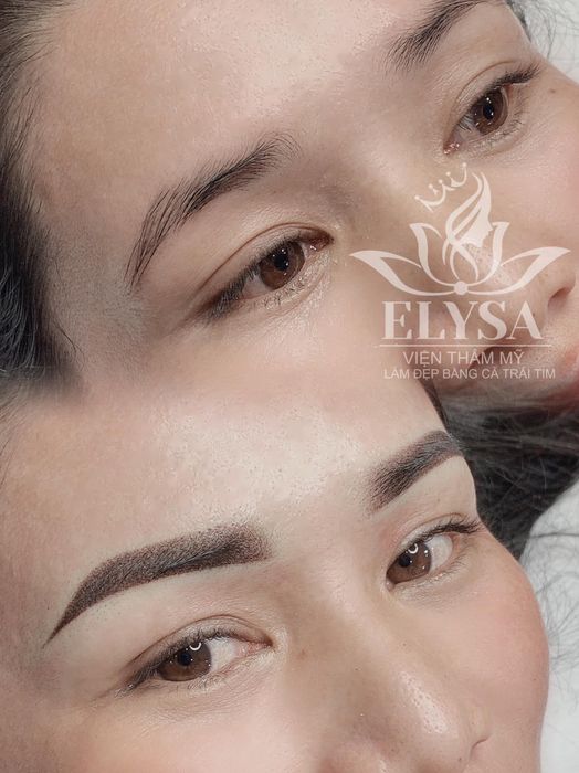 Viện Thẩm Mỹ Quốc Tế ELYSA - Hình ảnh 2
