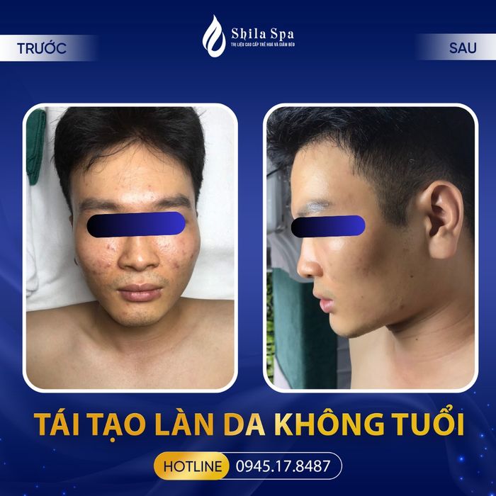 Shila Spa & Massage hình ảnh 2