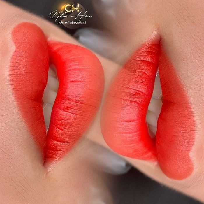 Hình ảnh 1 - Thẩm Mỹ Viện Quốc Tế Như Hoa