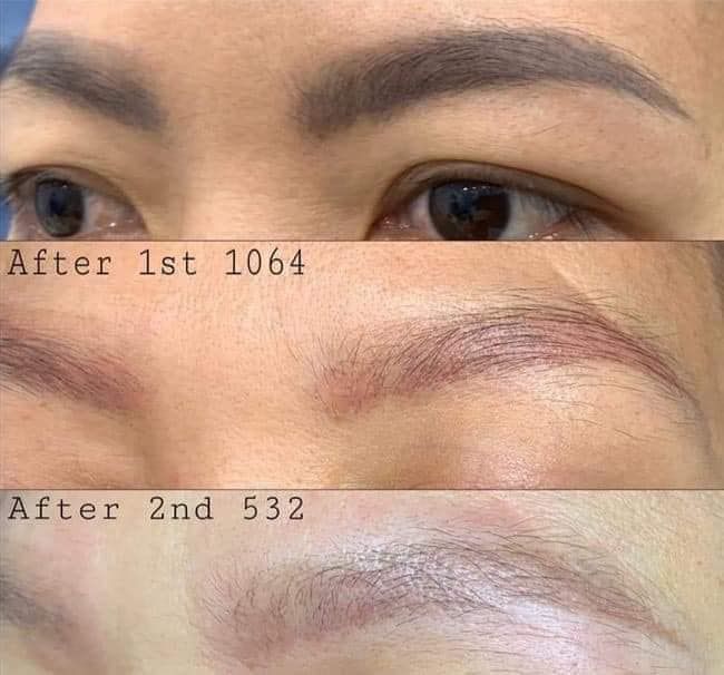 Hình ảnh Spa Nguyễn Vân