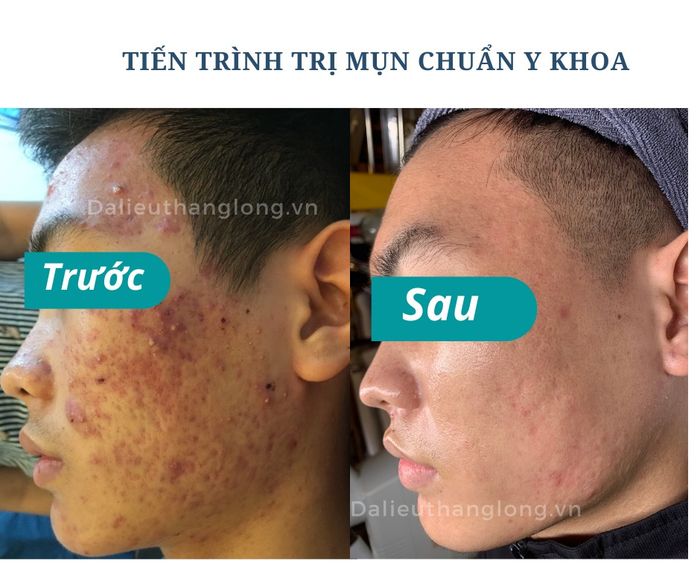 Thăng Long Beauty Clinic - Chi nhánh Ninh Bình hình ảnh 1
