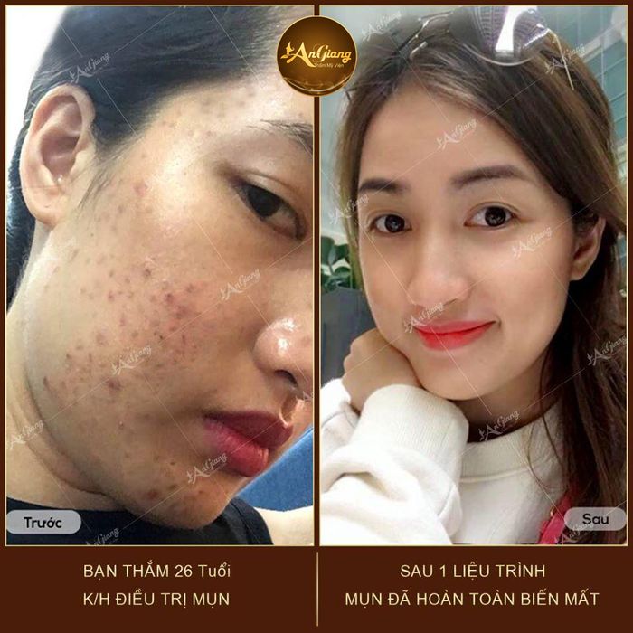 Hình ảnh 2 của An Giang Beauty & Spa