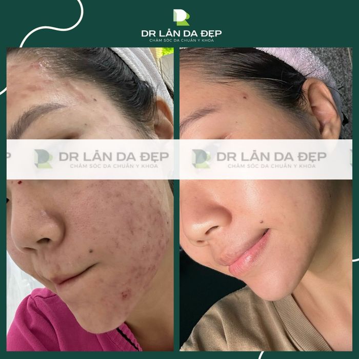 Hình ảnh 1 của DR Làn Da Đẹp Medical Spa