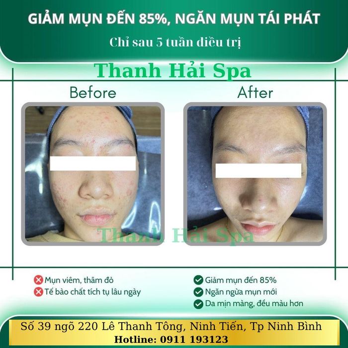 Hình ảnh 1 của Thanh Hải Spa