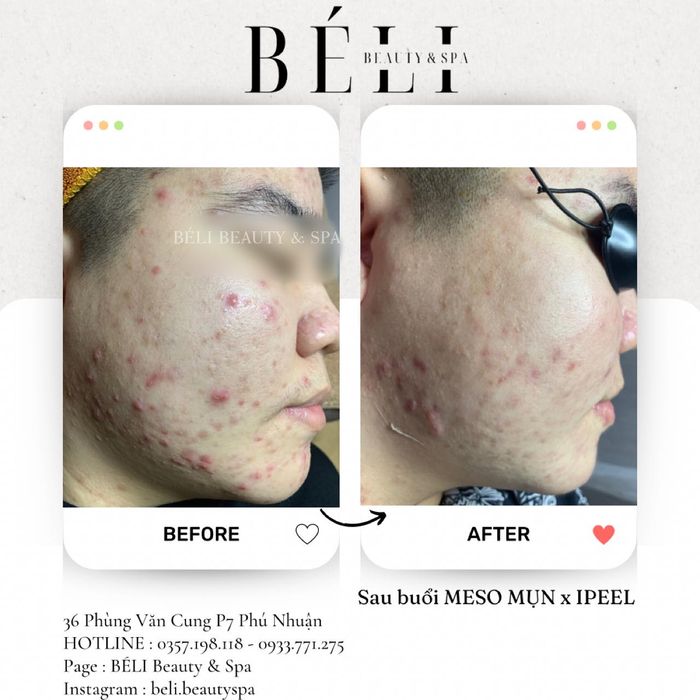 BÉLI Beauty & Spa ảnh 1