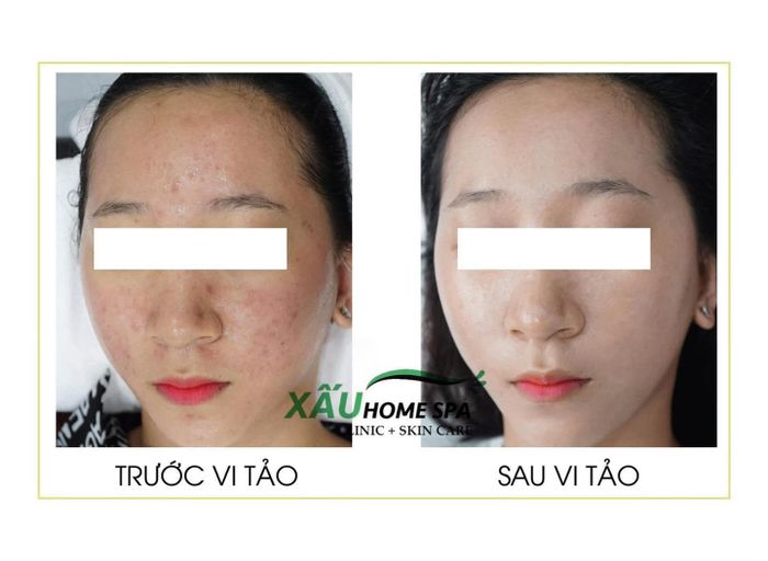 Hình ảnh Xấu Home Spa 2