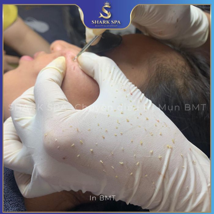 Ảnh SHARK Spa 2