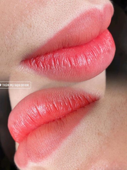 Hình ảnh Thẩm mỹ viện Dr Kim 2
