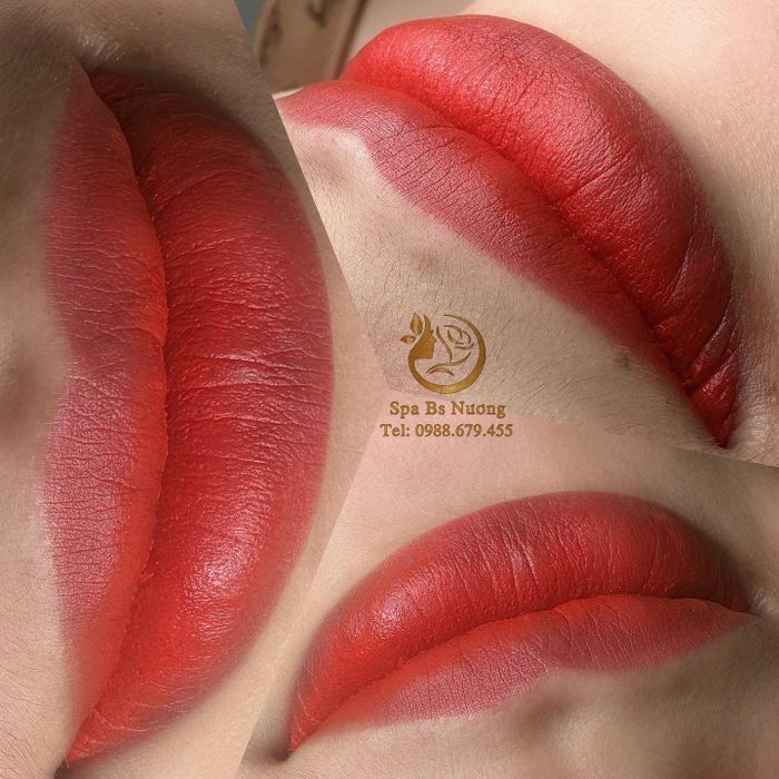 Hình ảnh Spa Bác Sỹ Nương 1