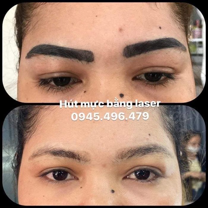 Ảnh 2 của Spa Nguyễn Vân