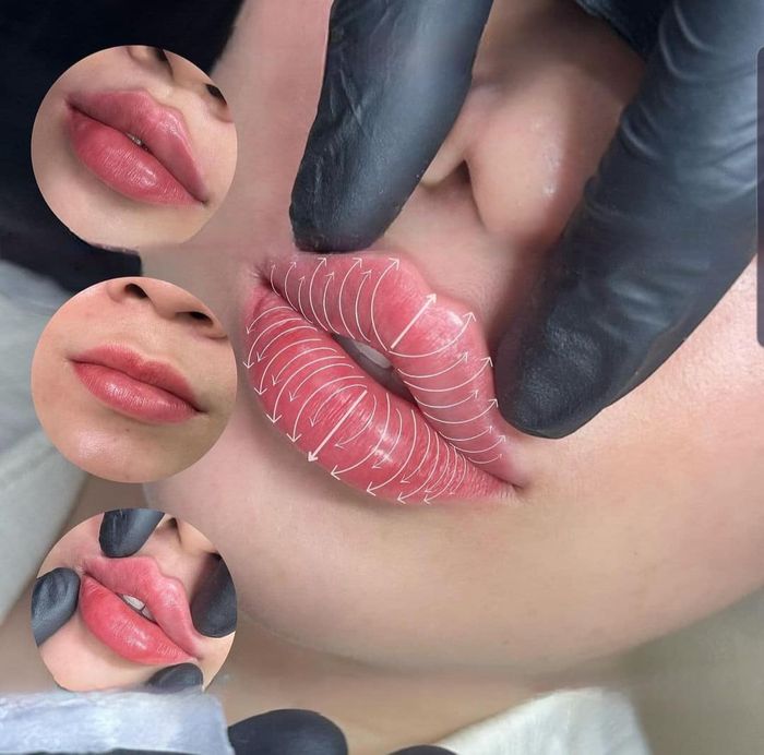 Hình ảnh 1 của Thẩm Mỹ Anh Nghi