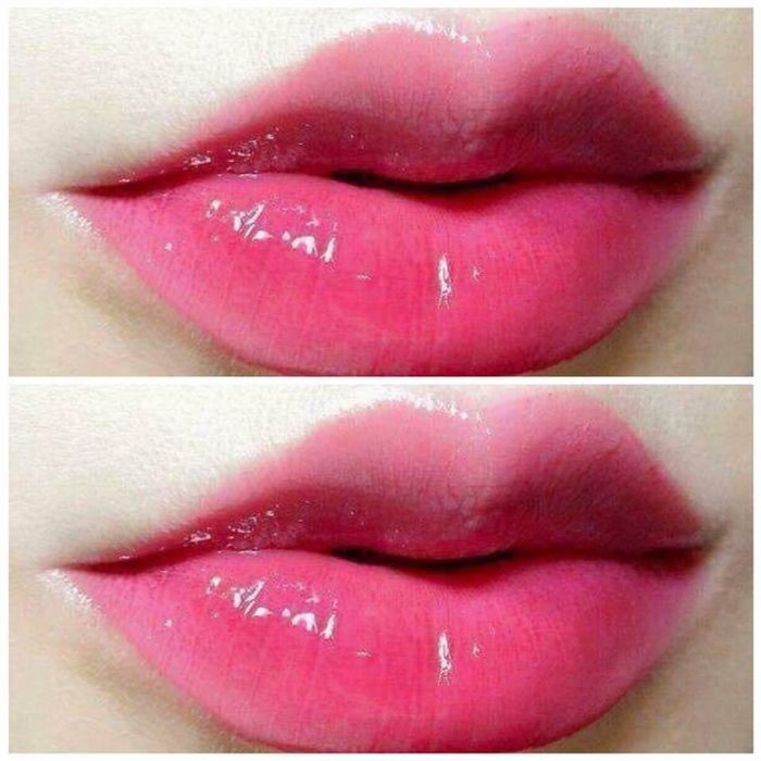 Hình ảnh 2 - Thẩm Mỹ Viện Hà Hương