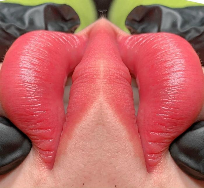 Hình ảnh 2 - Thẩm Mỹ Viện Hiền Vy