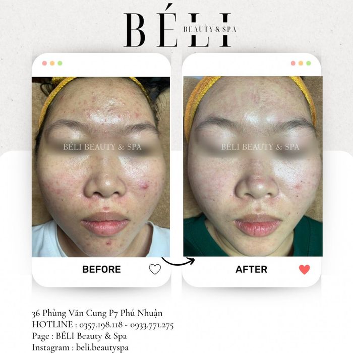 Hình ảnh 2 của BÉLI Beauty & Spa