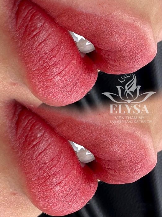 Viện Thẩm Mỹ Quốc Tế ELYSA - Hình ảnh 1