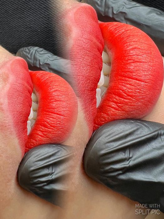 Ảnh 2 của Viện Thẩm Mỹ Yến Tít